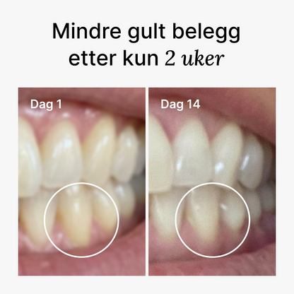 D2 Pro Elektrisk Tannbørste